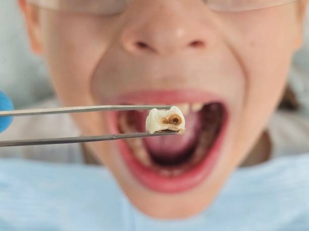 Best Pediatric Emergency Dentist in Jeffersonville, KY